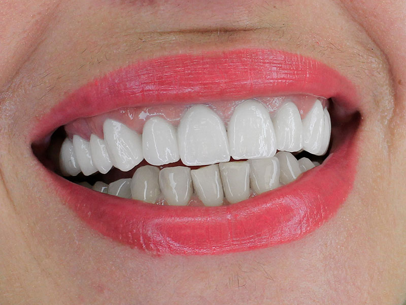 @euro-dental-centar-final-br1-dr-selma