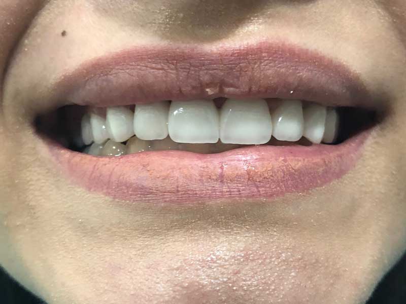 @euro-dental-centar-sarajevo-nasi-radovi-poslije-F