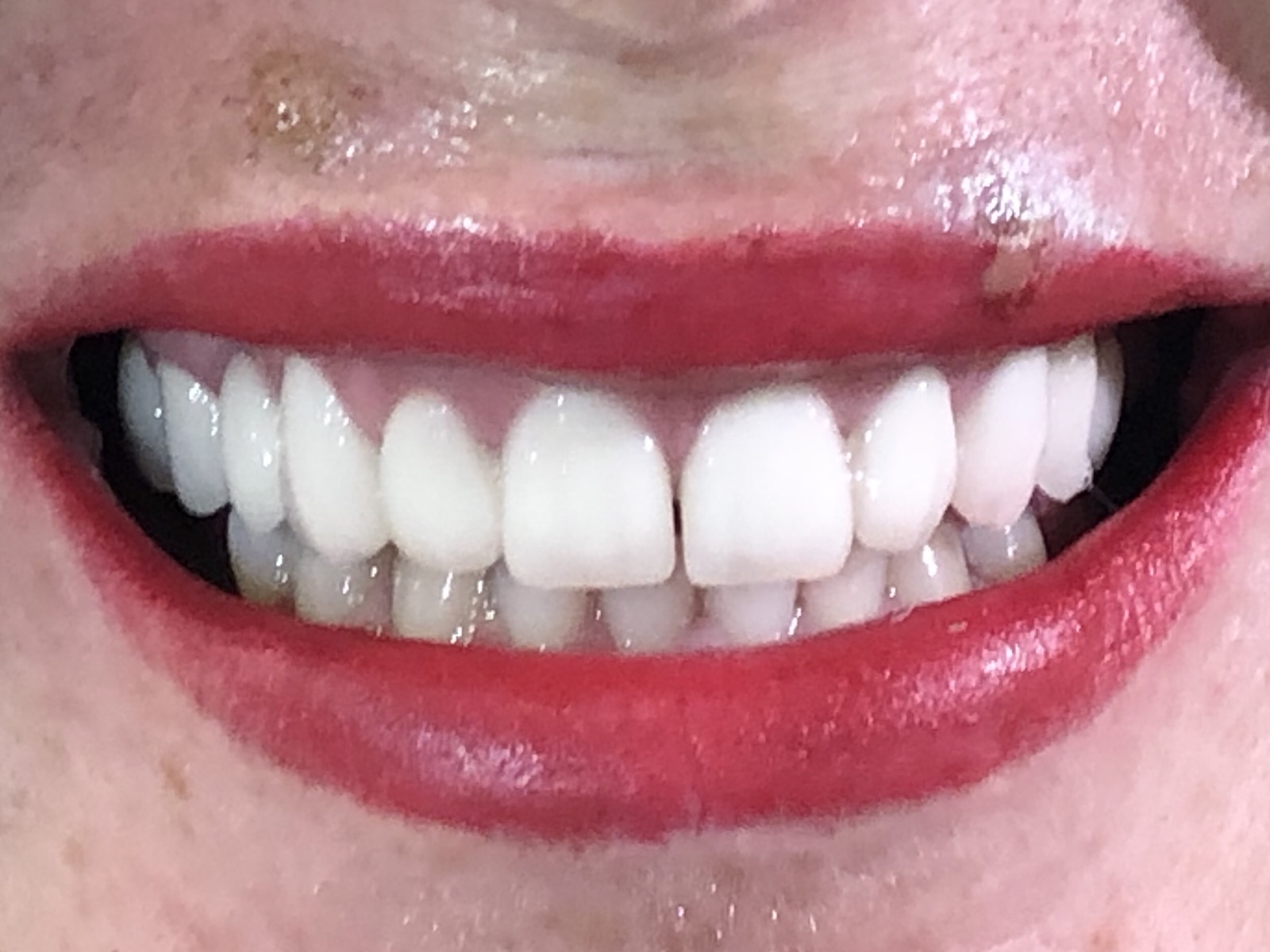 @euro-dental-centar-sarajevo-nasi-radovi-poslije-I