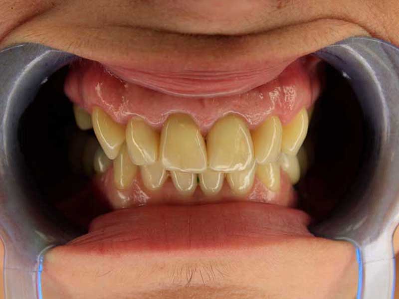 @euro-dental-centar-sarajevo-nasi-radovi---prije-A1