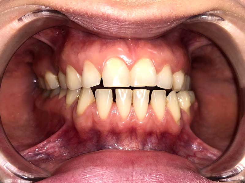 @euro-dental-centar-sarajevo-nasi-radovi-prije-Aa1