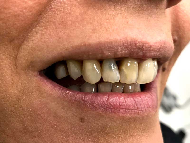 @euro-dental-centar-sarajevo-nasi-radovi-prije-B