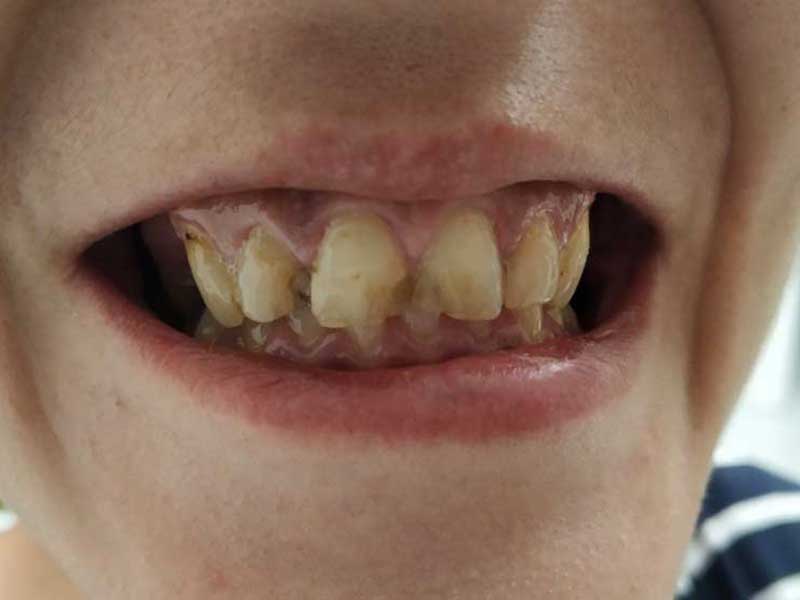 @euro-dental-centar-sarajevo-nasi-radovi-prije-C