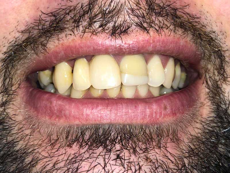 @euro-dental-centar-sarajevo-nasi-radovi-prije-D