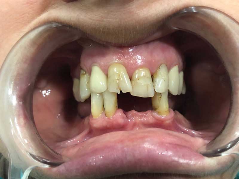 @euro-dental-centar-sarajevo-nasi-radovi-prije-F