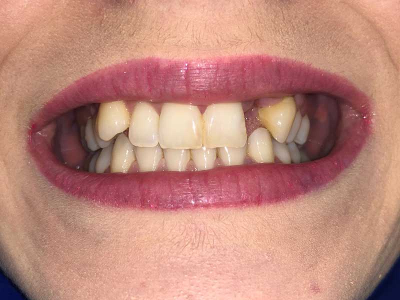 @euro-dental-centar-sarajevo-nasi-radovi-prije-G