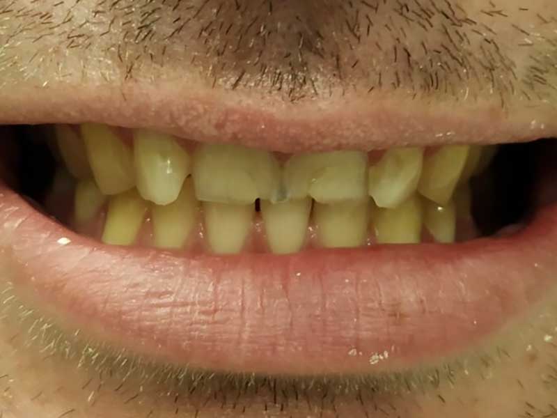 @euro-dental-centar-sarajevo-nasi-radovi-prije-H