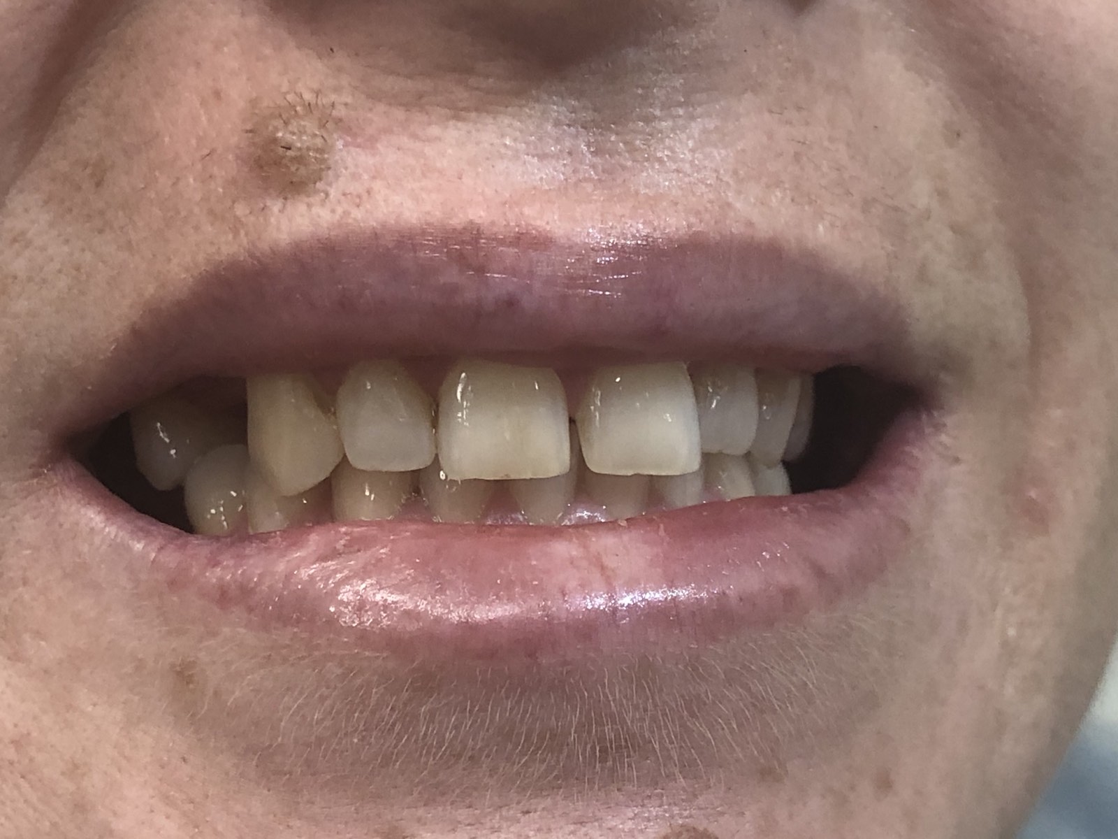 @euro-dental-centar-sarajevo-nasi-radovi-prije-I