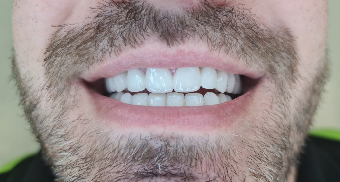 4-poslije