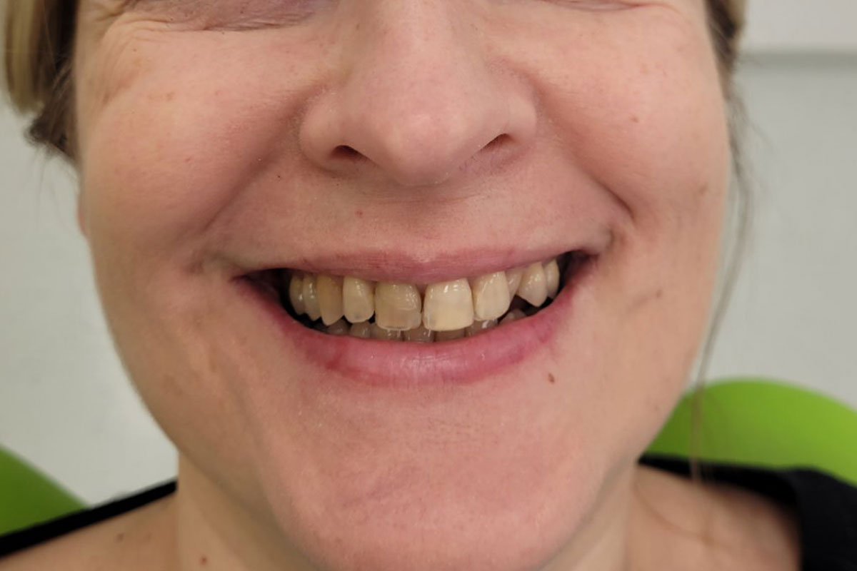 prije-eurodental-centar-br11