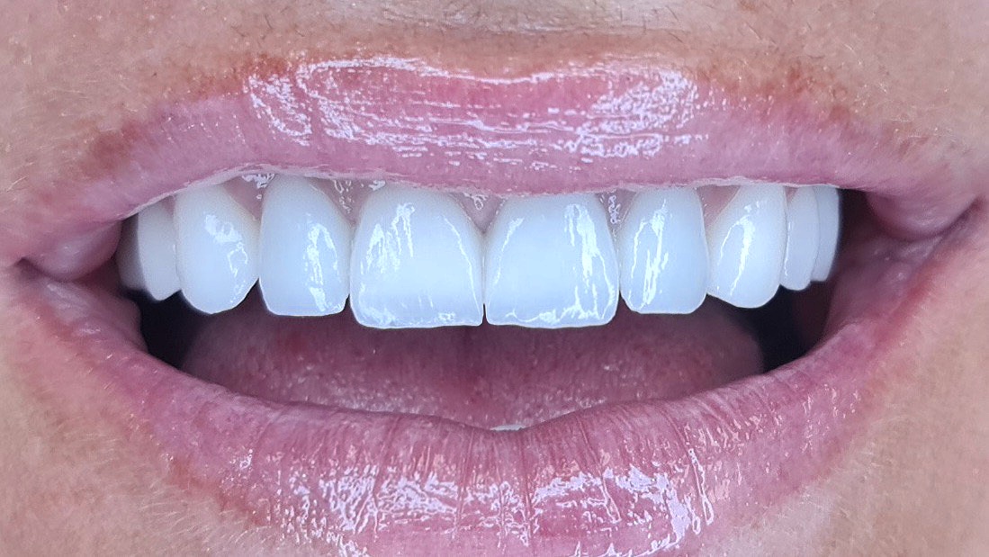 poslije-eurodental-new