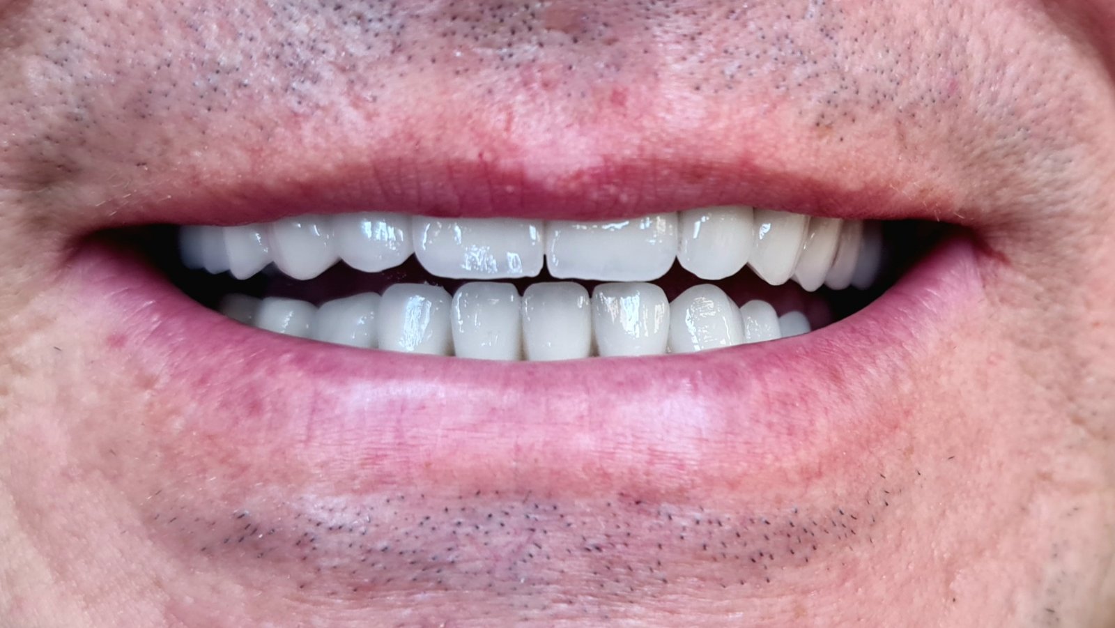 poslije-eurodental-new2