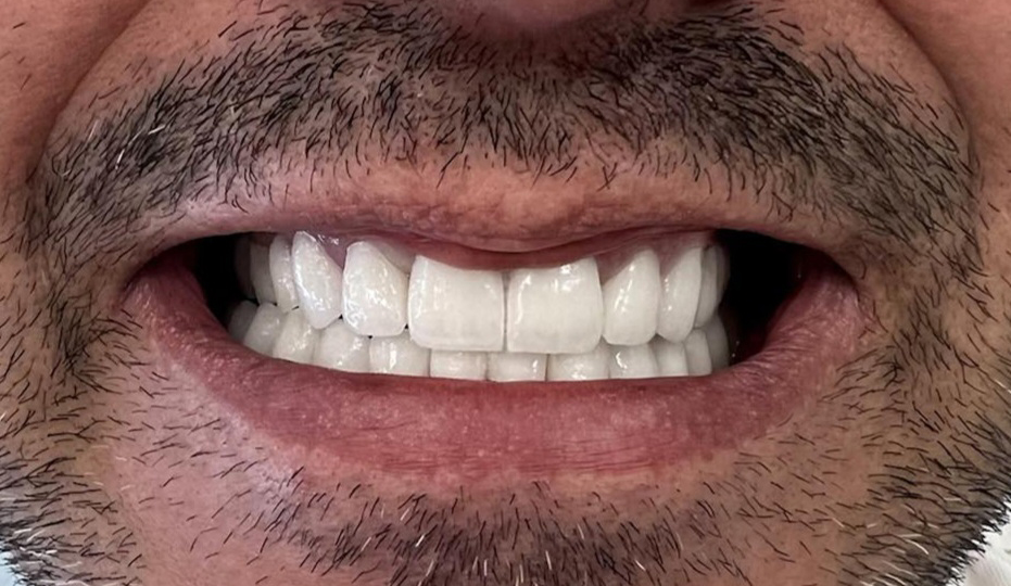 poslije-eurodental-nn2-fff