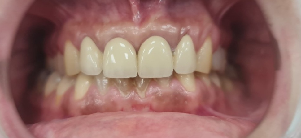 prije-eurodental-new