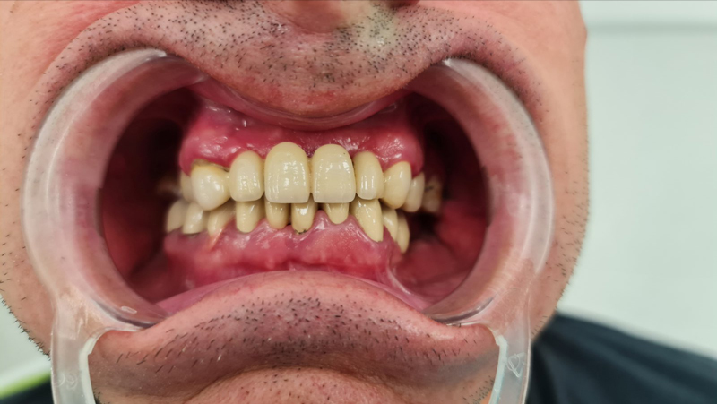 prije-eurodental-new2aa
