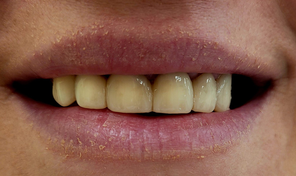 eurodental-prije2-f