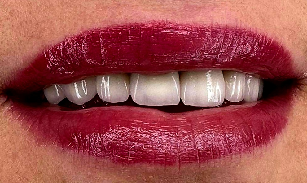 eurodentalposlije2
