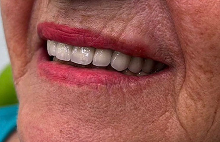 poslije-z-eurodental-centar3004