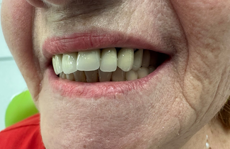 prije-z-eurodental-centar3004