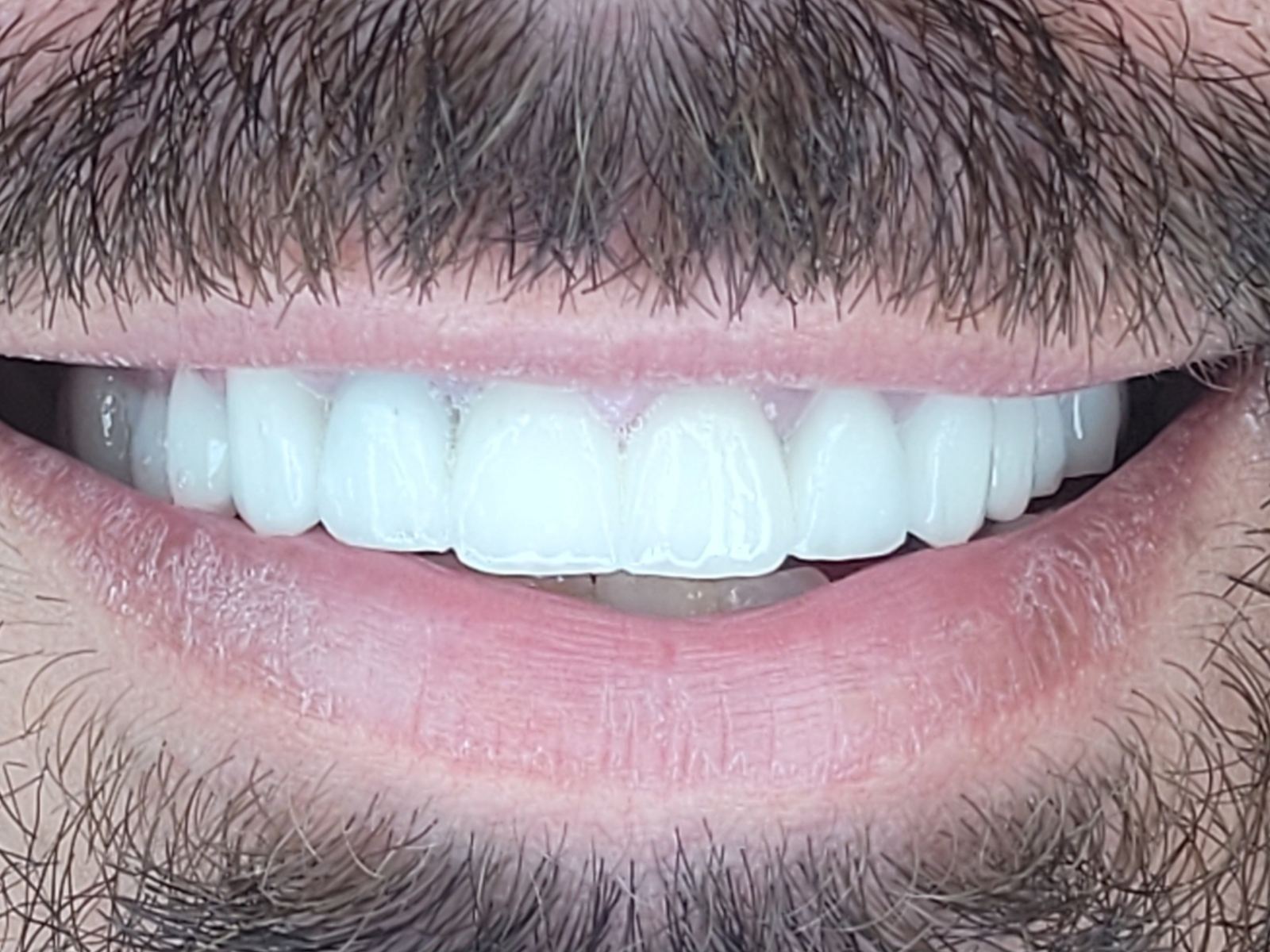 poslije-eurodentalcentar-n