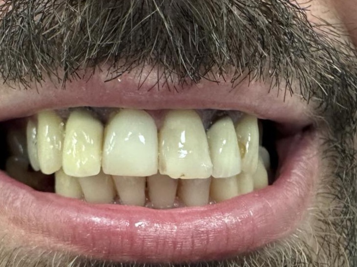 prije-eurodentalcentar-n