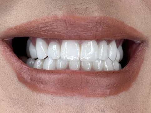 poslije-eurodentalcentar2024