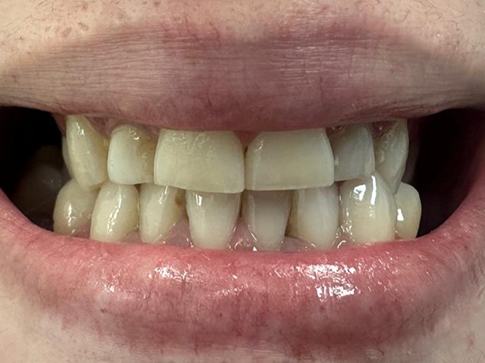prije-eurodentalcentar2024-f